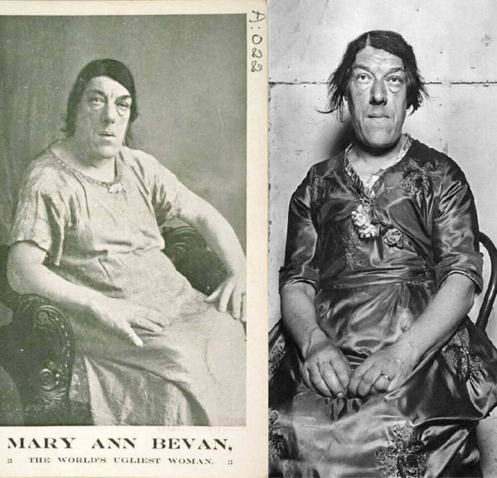 Mary Ann Bevan: Η πιο άσχημη γυναίκα στον κόσμο που έσωσε τα παιδιά της